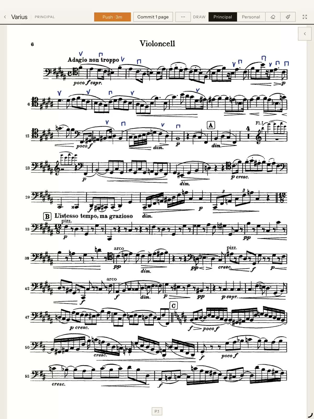 Principal violin's iPad: drawing a new bowing on the score and tapping push.